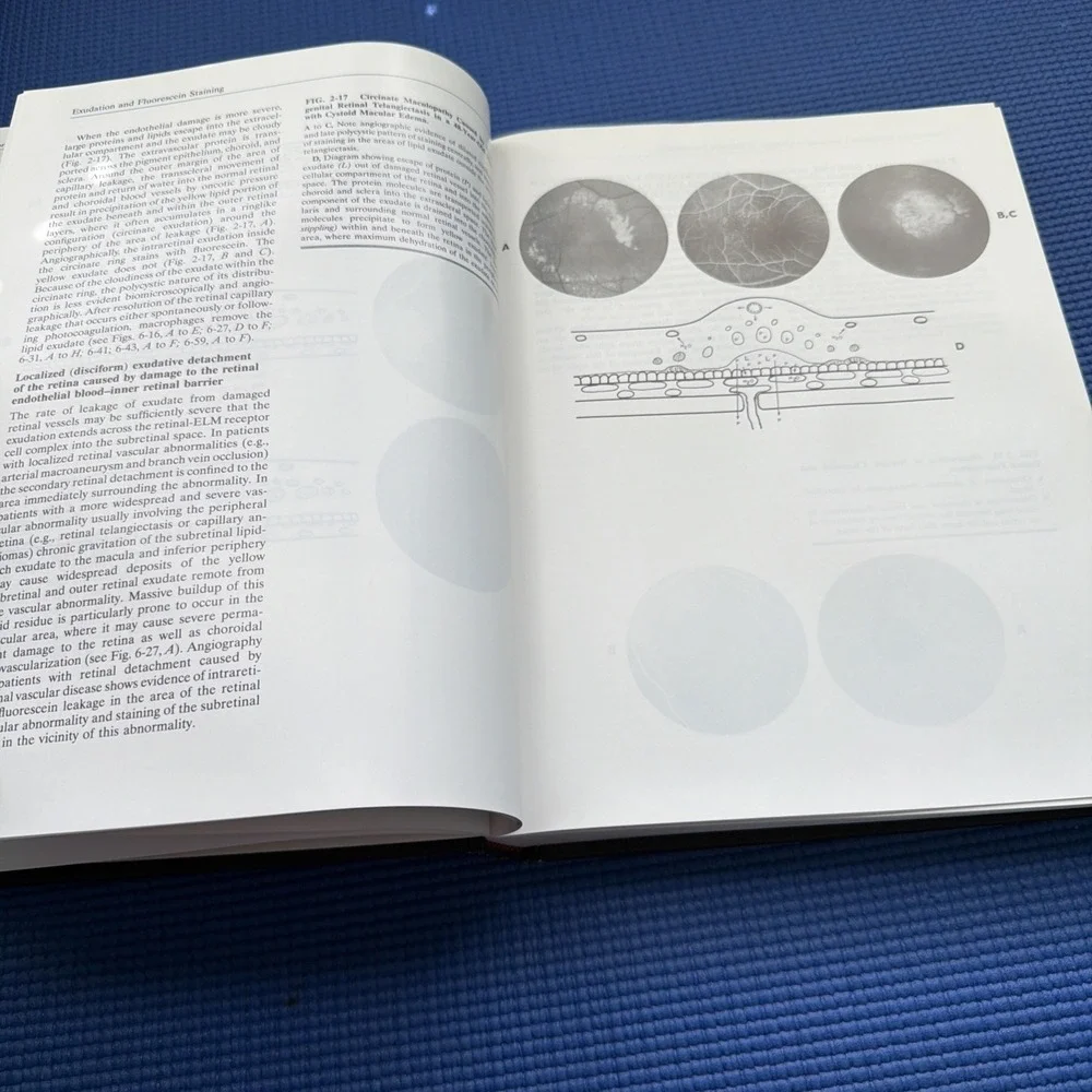 Excellent Stereoscopic Atlas of Macular Diseases by Gass (1996, Hardcover) Vol.1